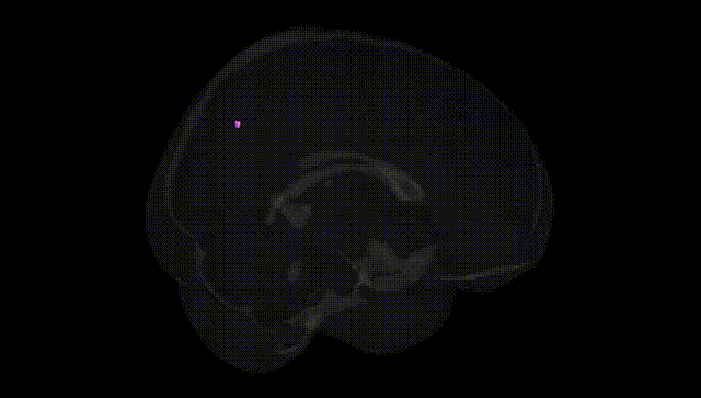 Full Brain Black