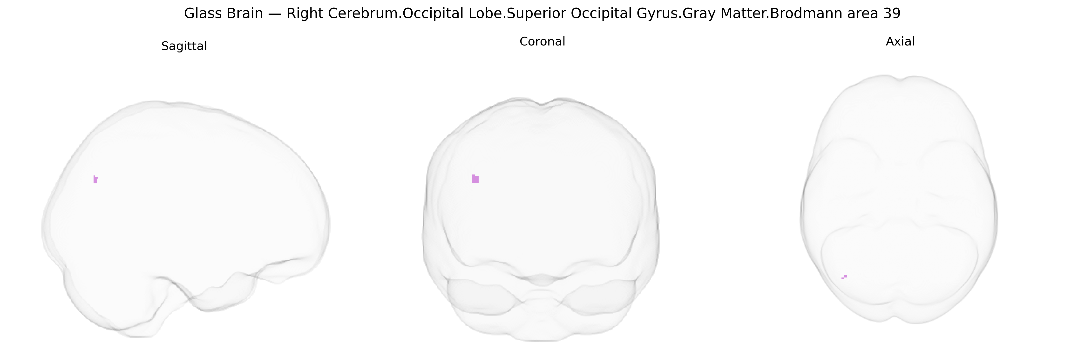Triplanar Ghost Brain