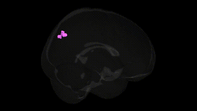 Full Brain Black