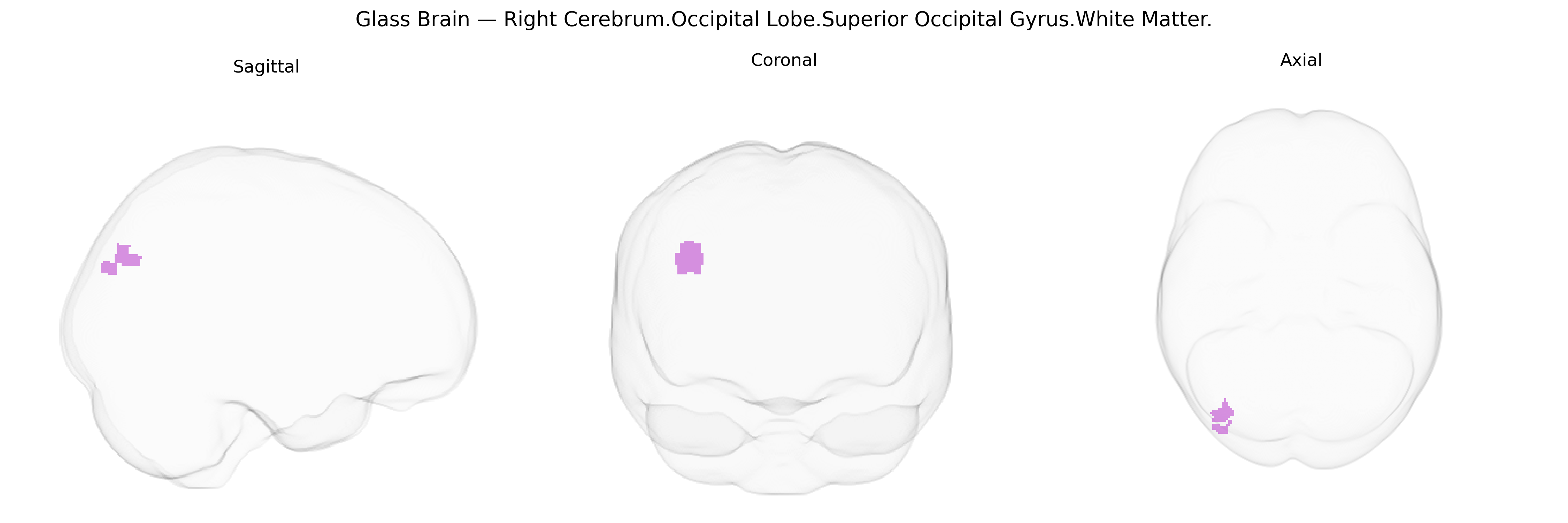 Triplanar Ghost Brain