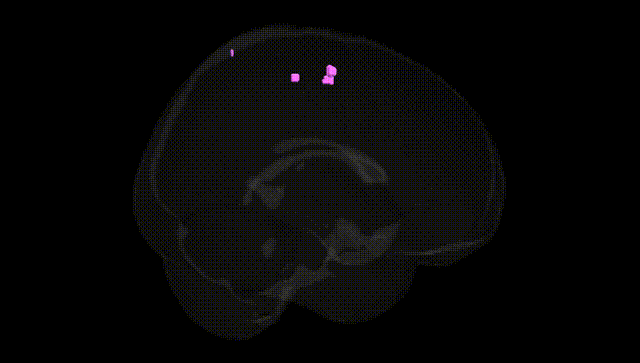 Full Brain Black