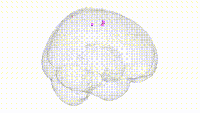 Full Brain White
