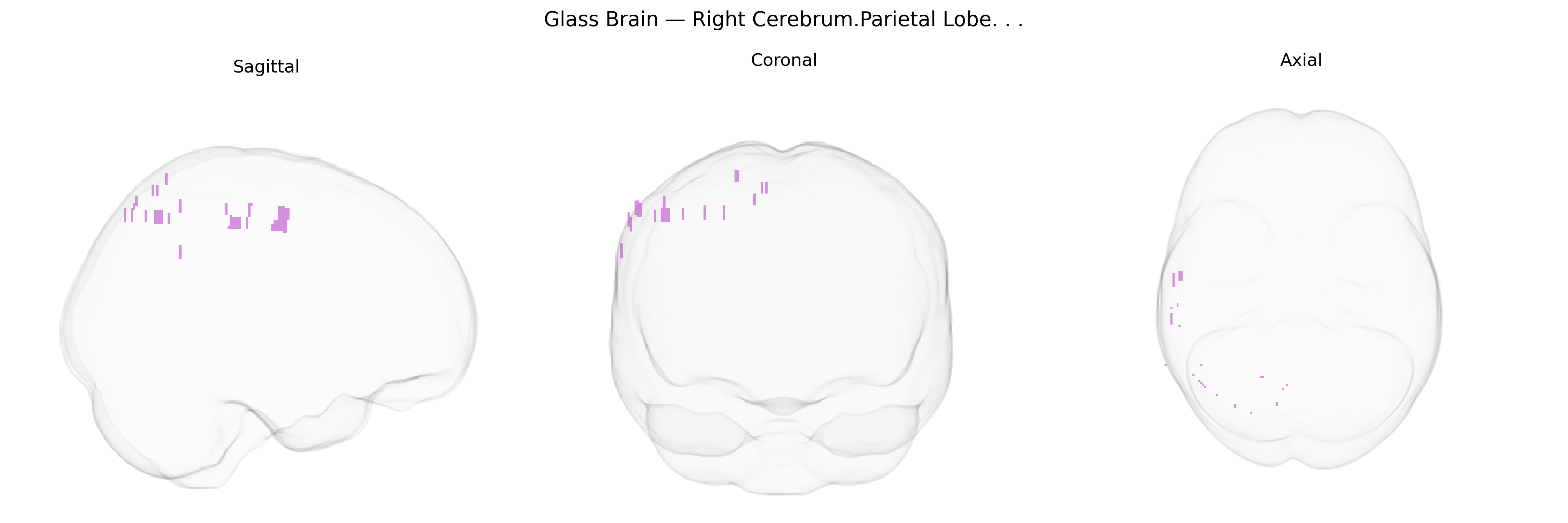 Triplanar Ghost Brain