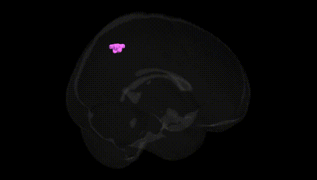 Full Brain Black