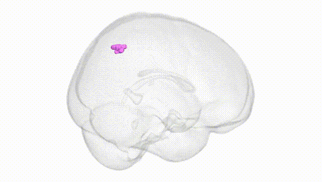 Full Brain White