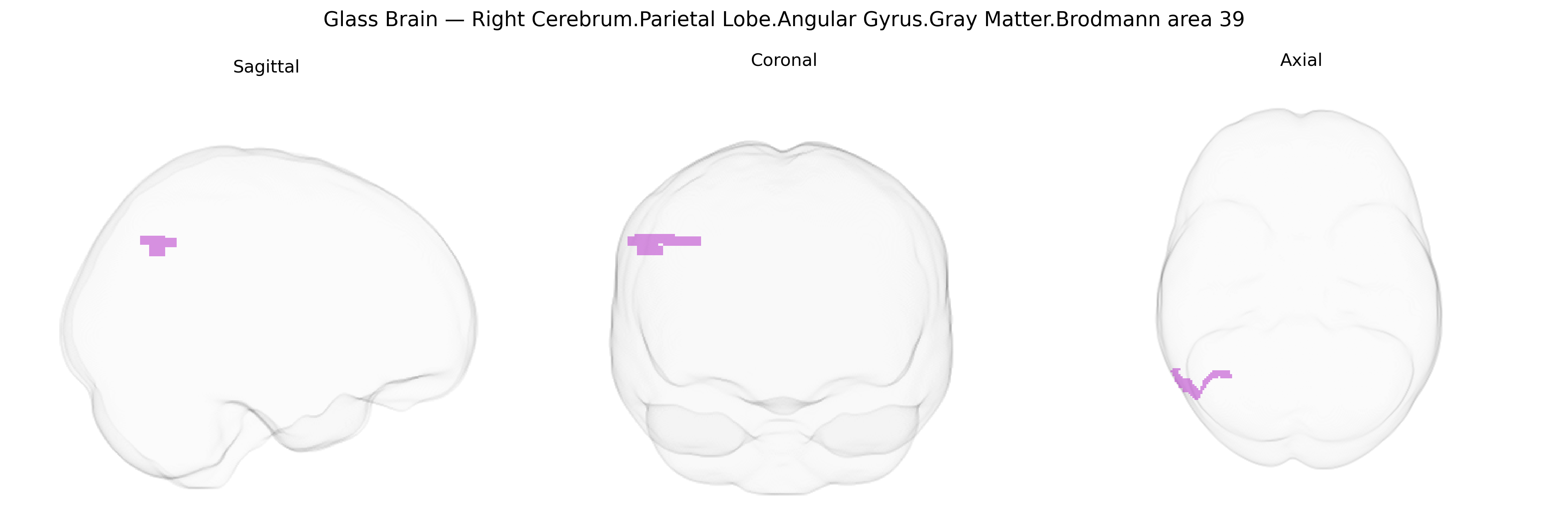 Triplanar Ghost Brain