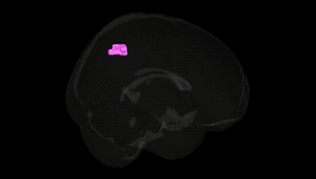 Full Brain Black