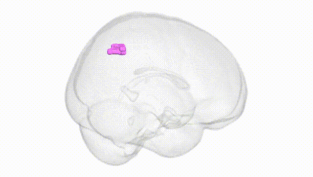 Full Brain White