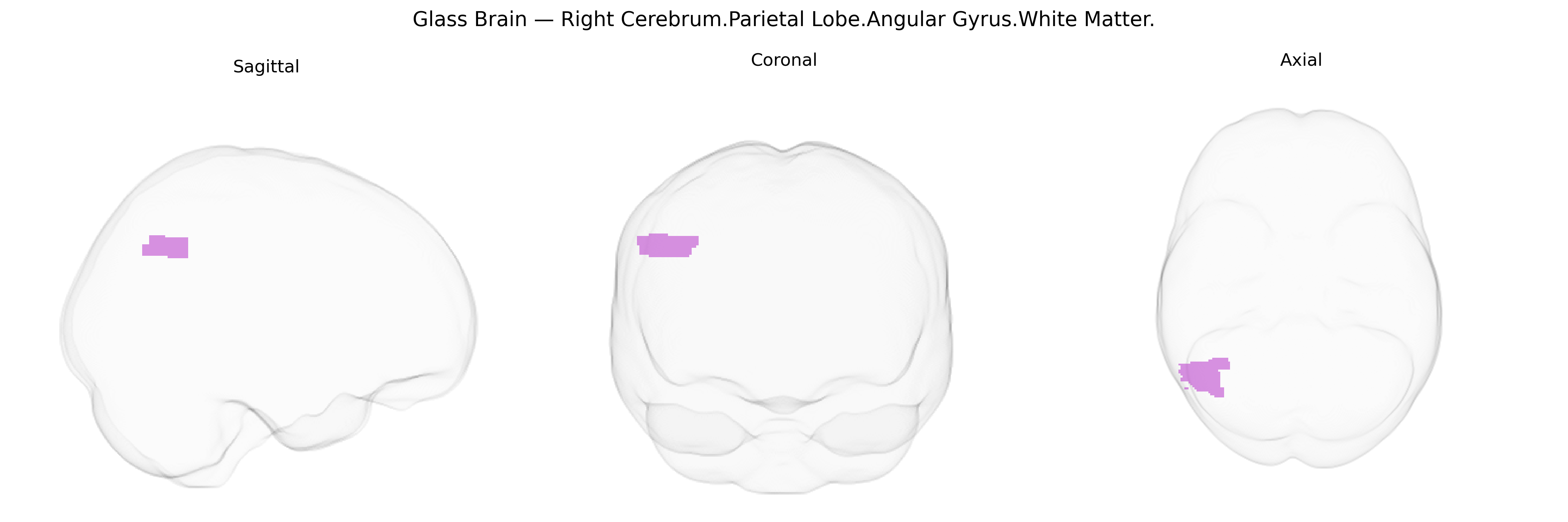 Triplanar Ghost Brain