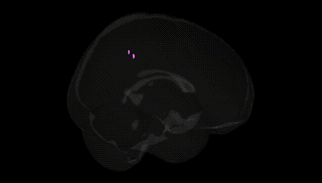 Full Brain Black