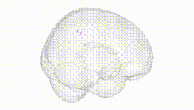 Full Brain White