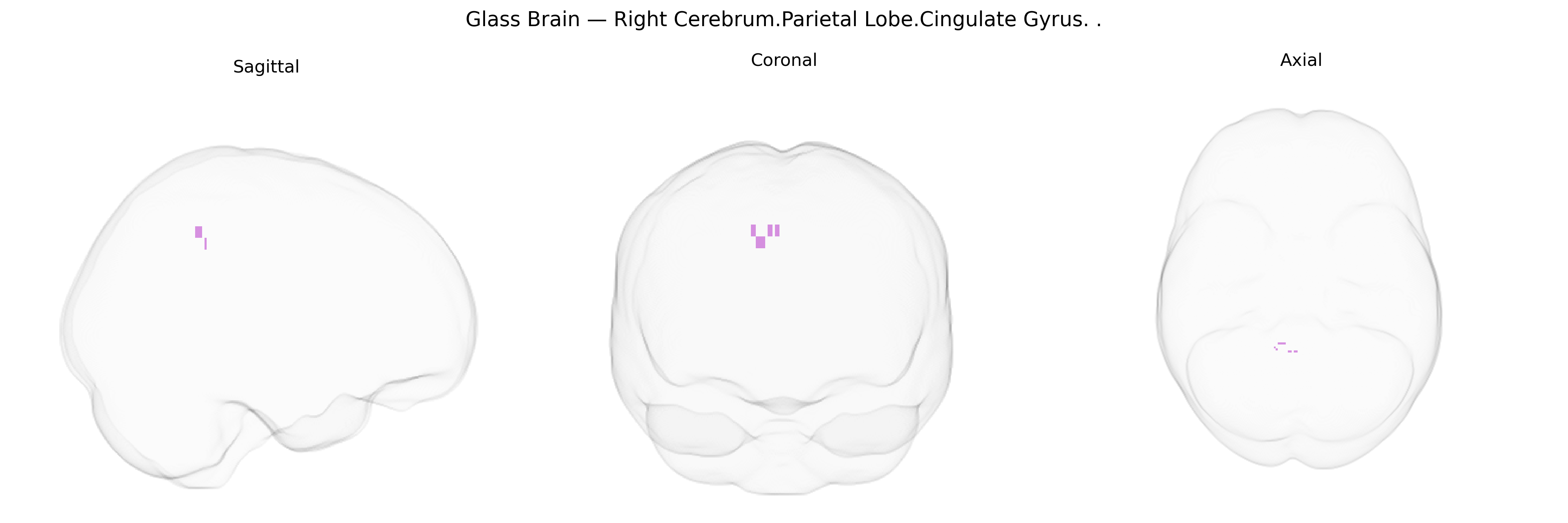 Triplanar Ghost Brain