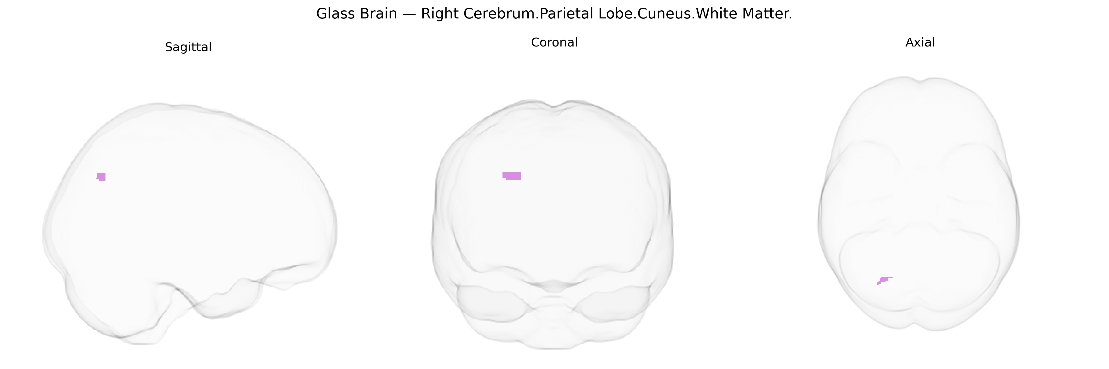 Triplanar Ghost Brain