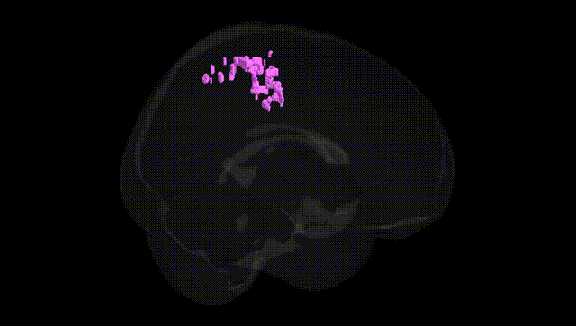 Full Brain Black