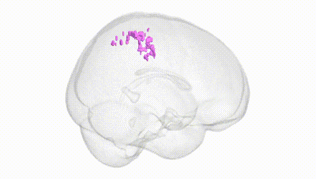 Full Brain White