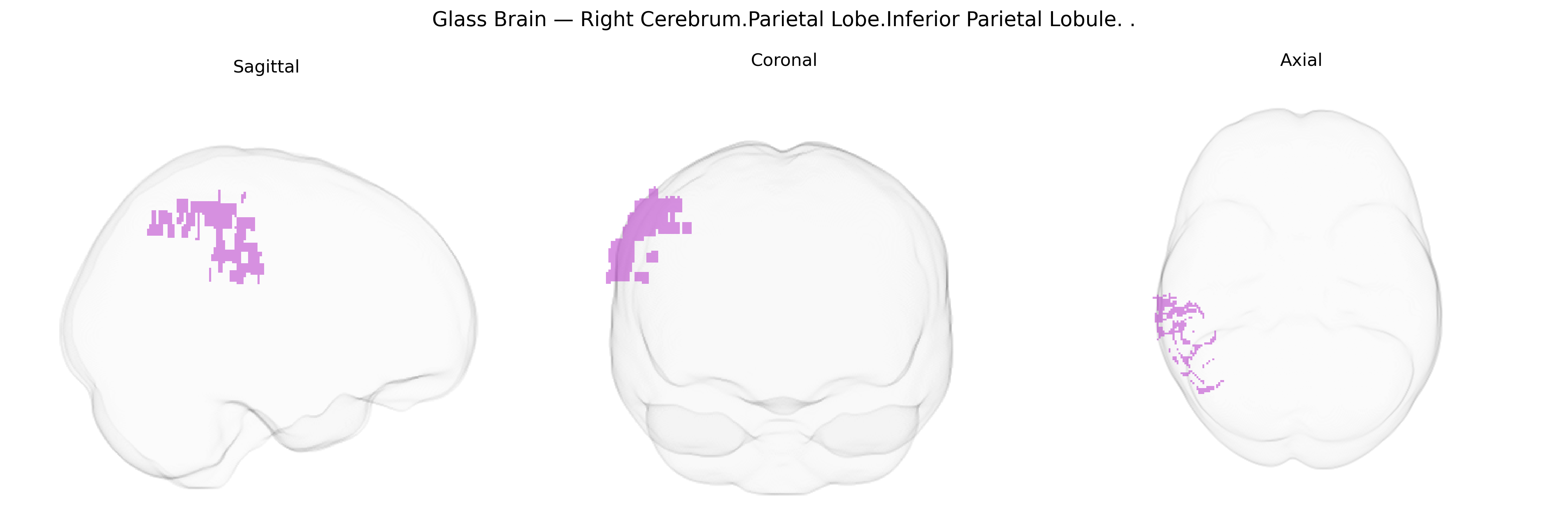 Triplanar Ghost Brain