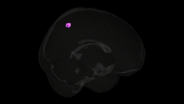 Full Brain Black