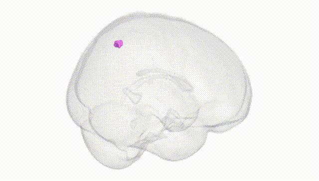 Full Brain White