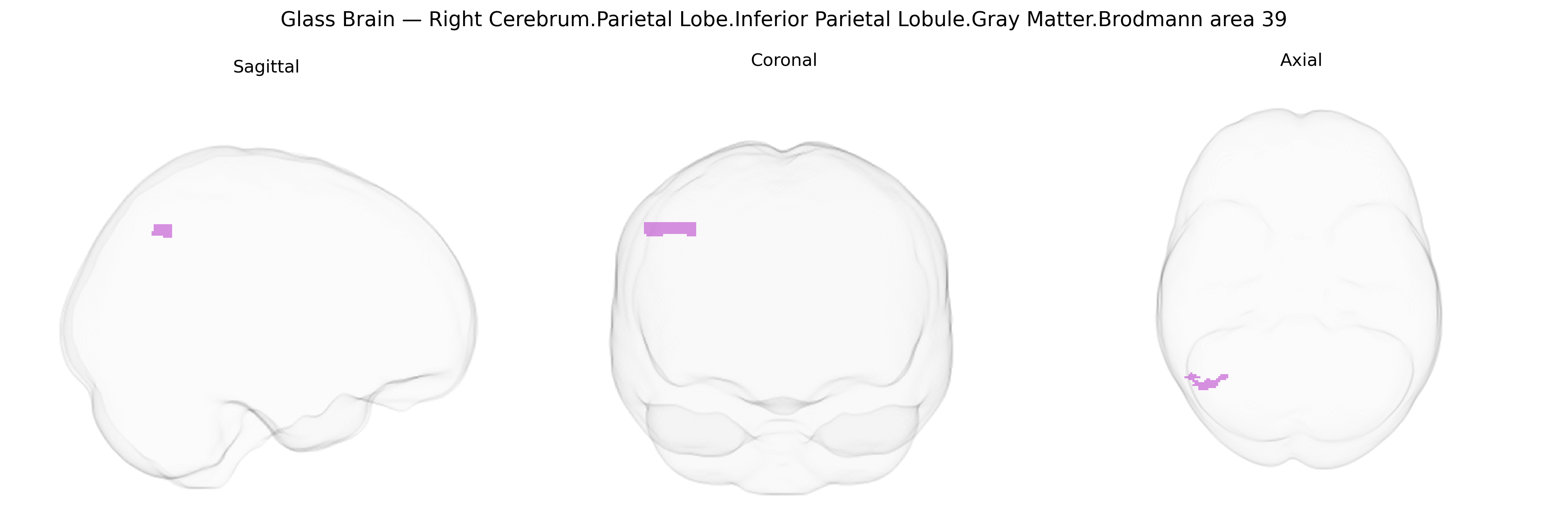 Triplanar Ghost Brain
