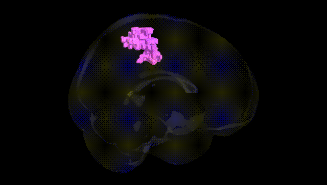 Full Brain Black