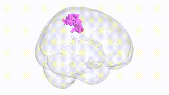 Full Brain White