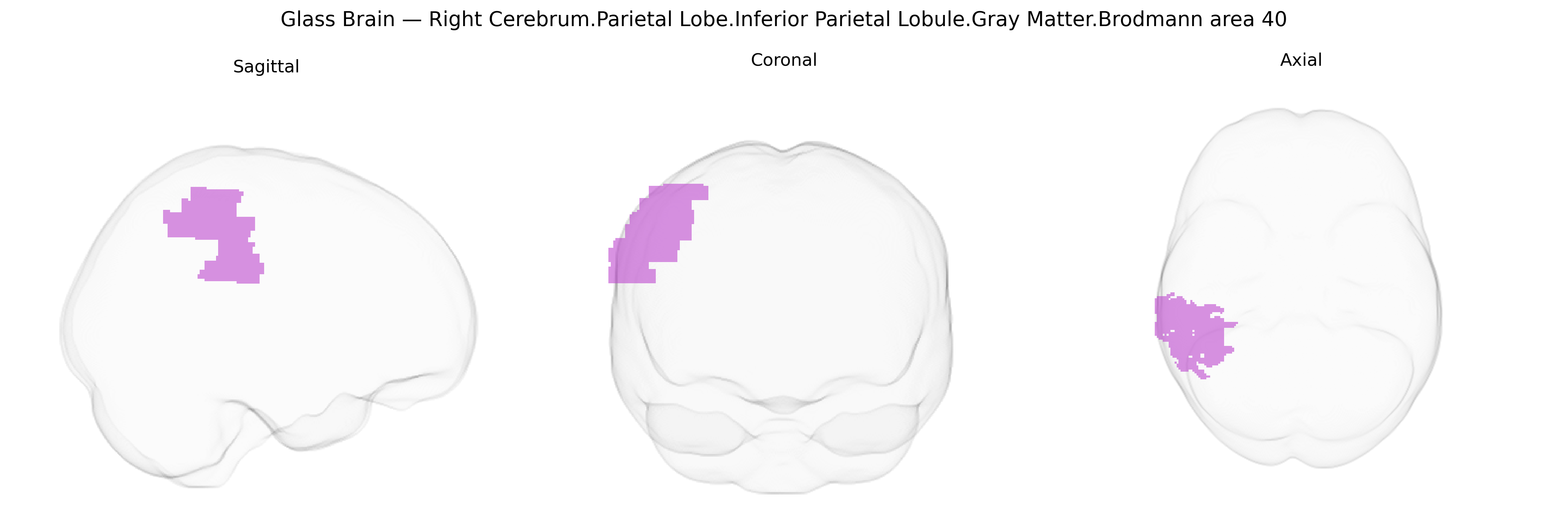 Triplanar Ghost Brain