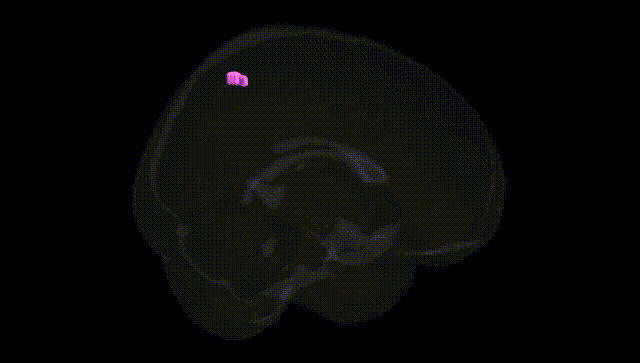 Full Brain Black