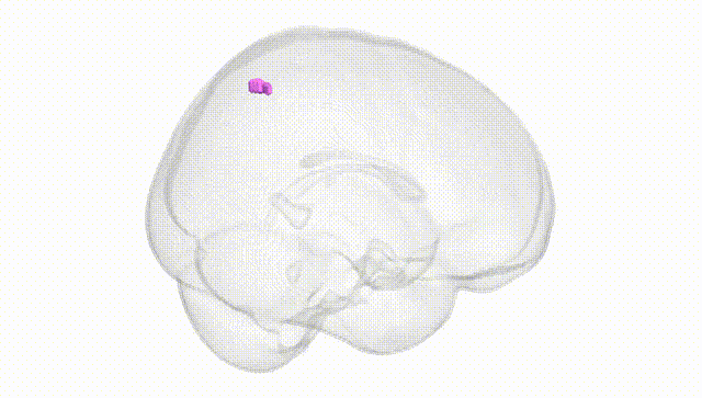 Full Brain White