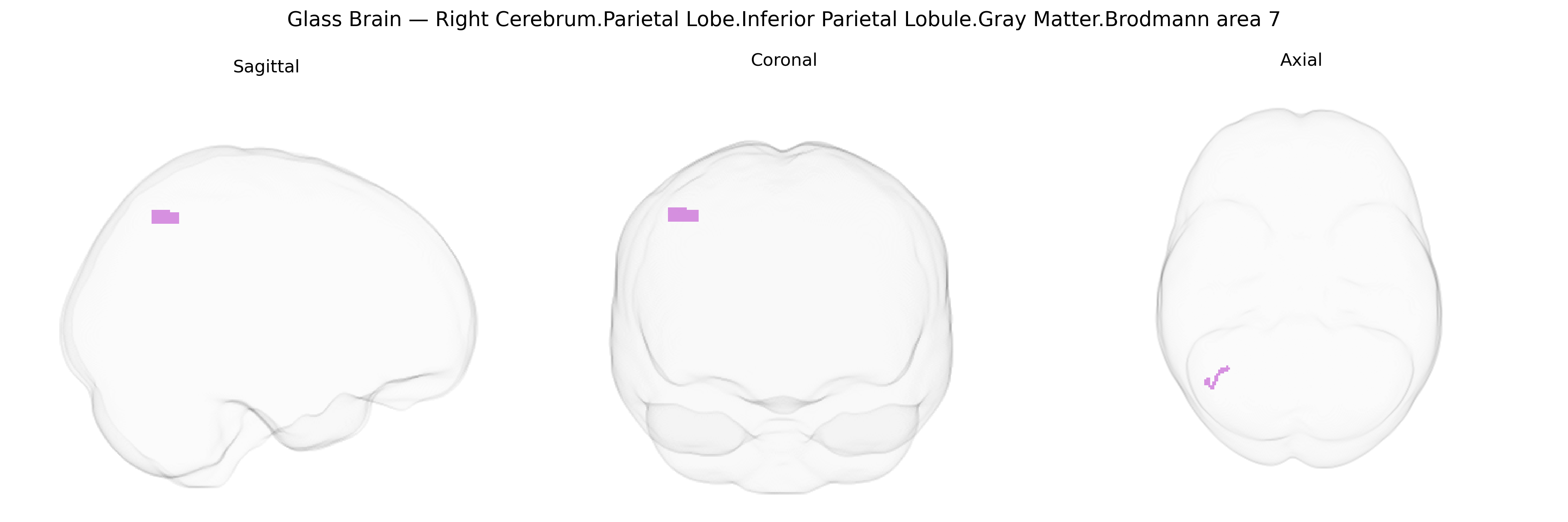Triplanar Ghost Brain