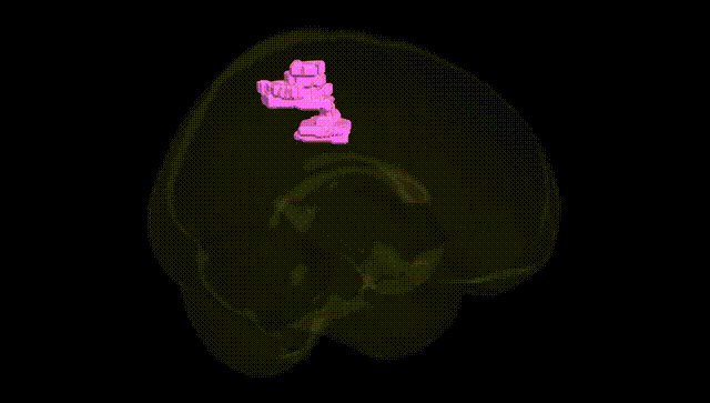 Full Brain Black