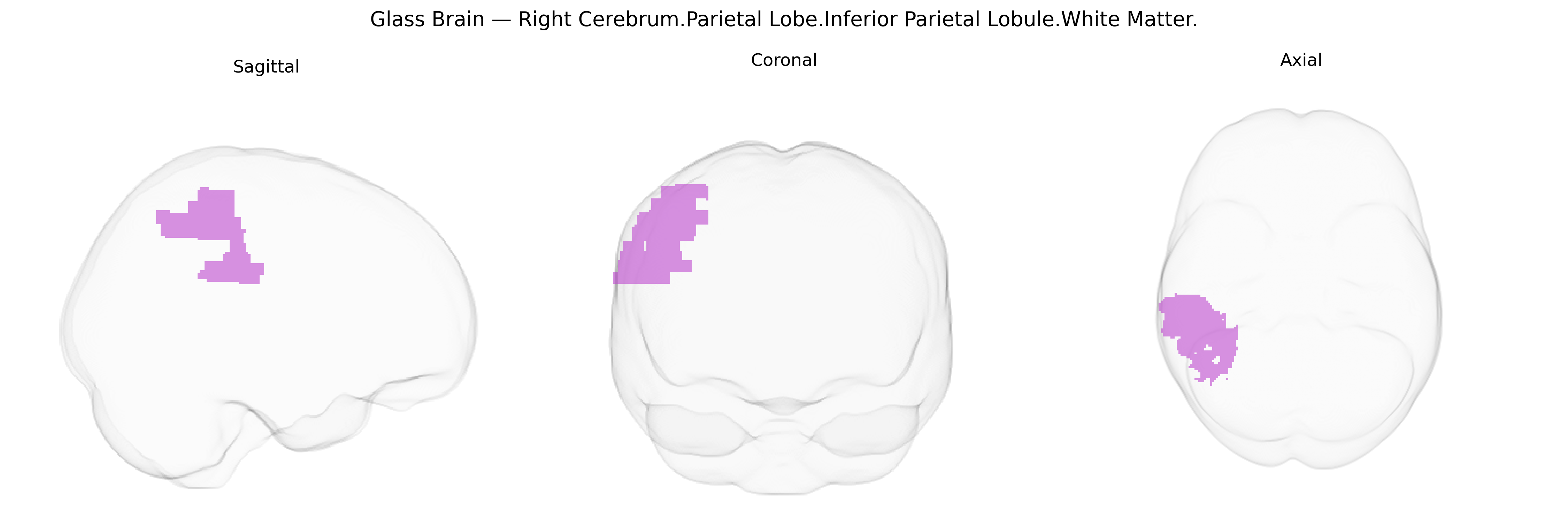 Triplanar Ghost Brain