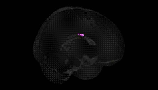 Full Brain Black