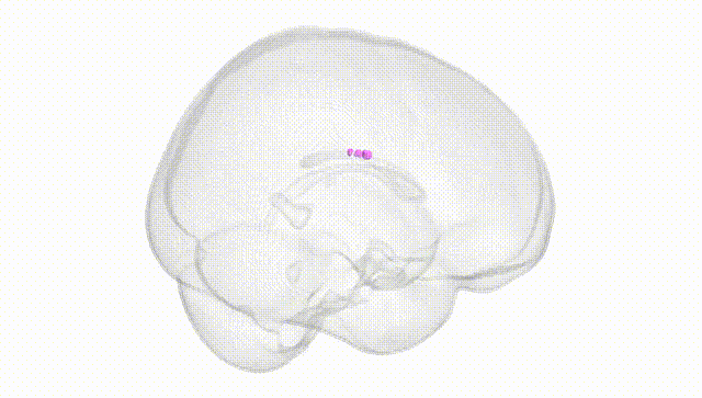 Full Brain White