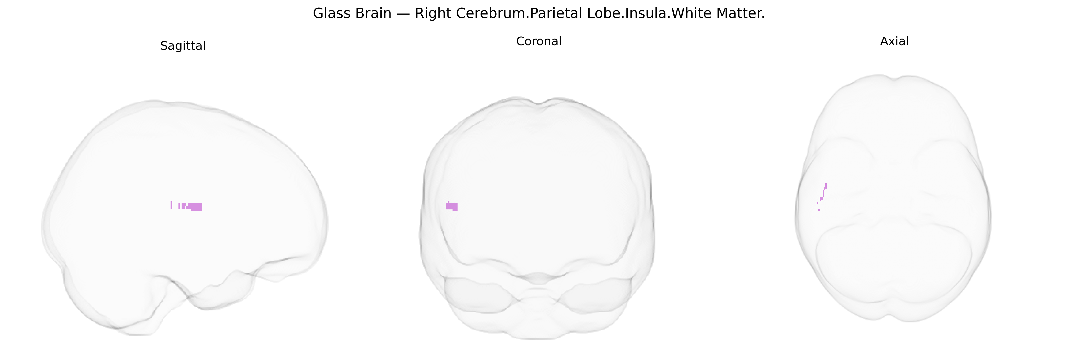 Triplanar Ghost Brain