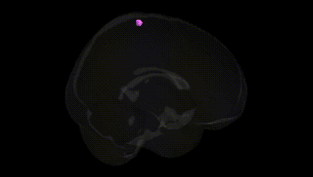 Full Brain Black