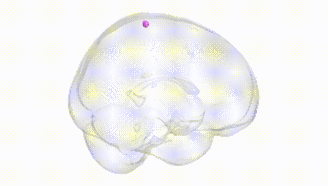 Full Brain White