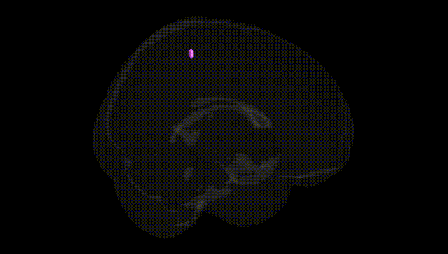 Full Brain Black