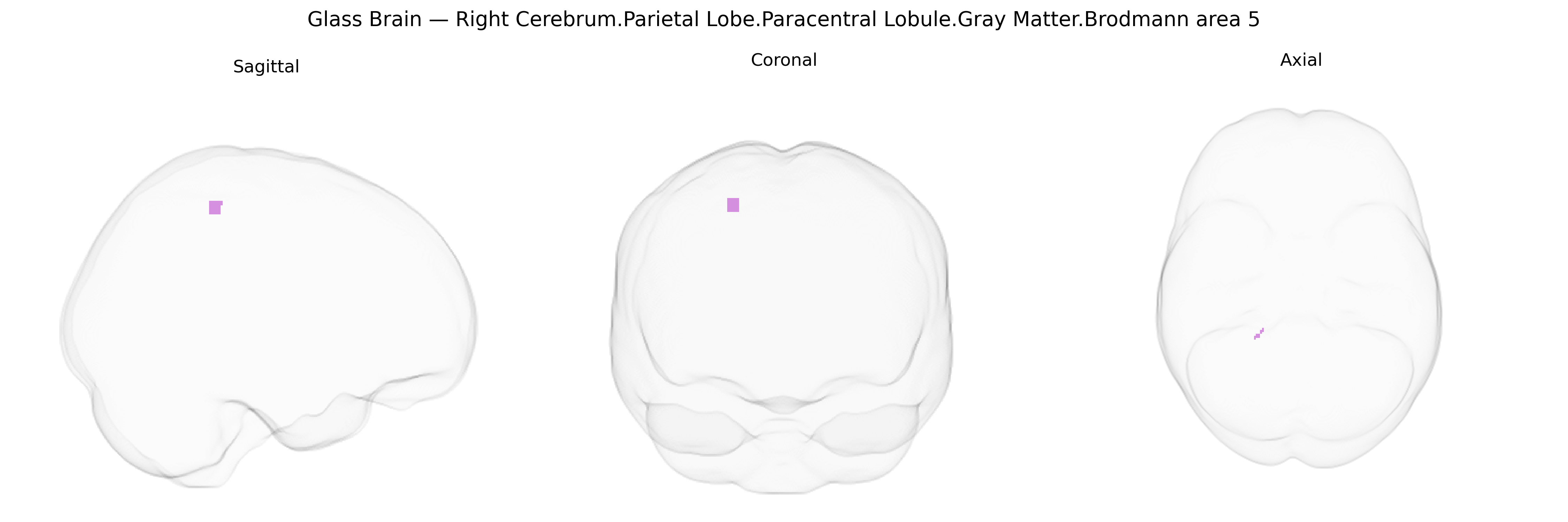 Triplanar Ghost Brain