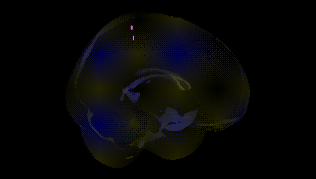Full Brain Black