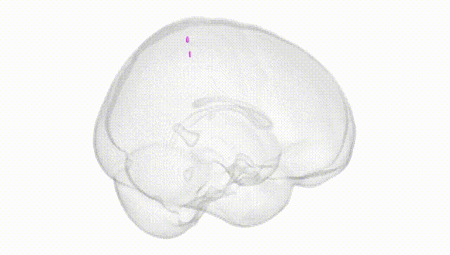 Full Brain White