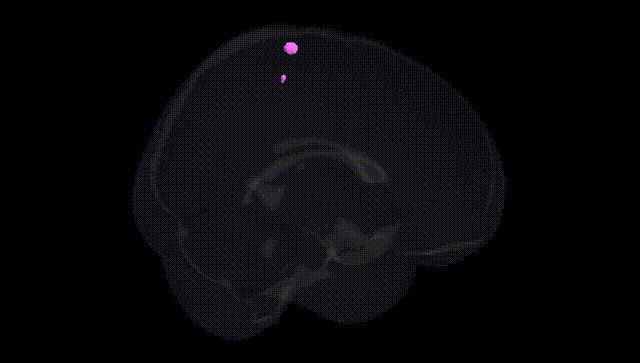Full Brain Black