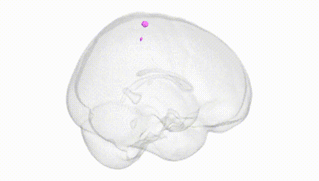 Full Brain White