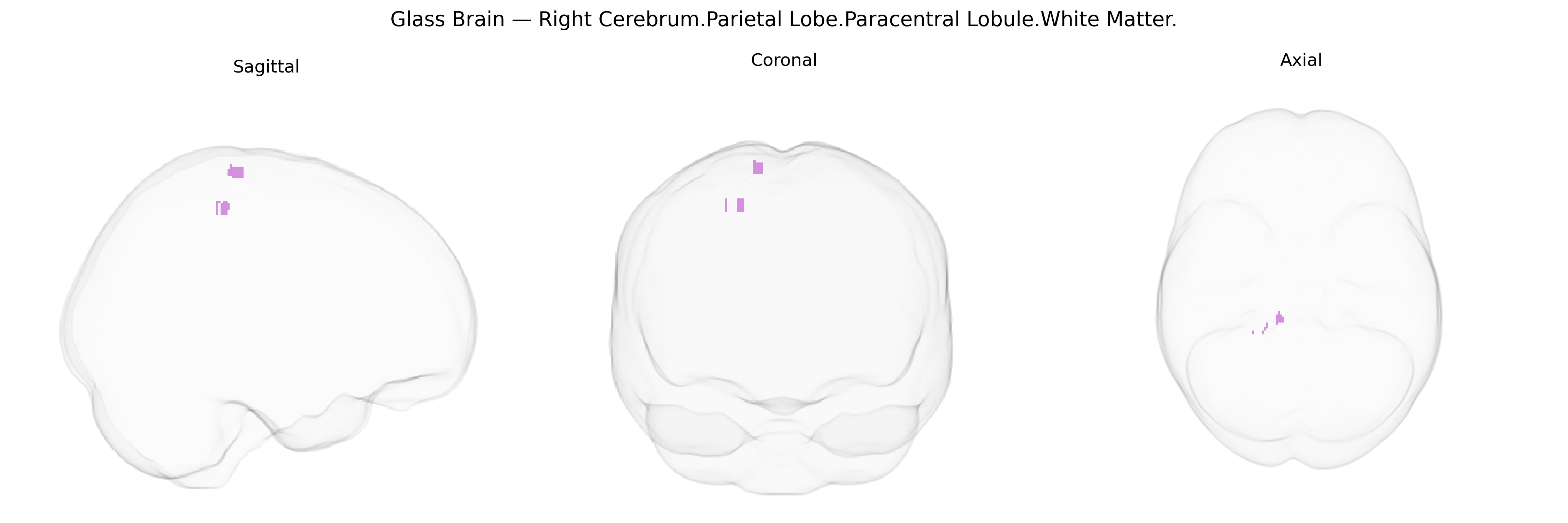 Triplanar Ghost Brain