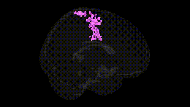 Full Brain Black