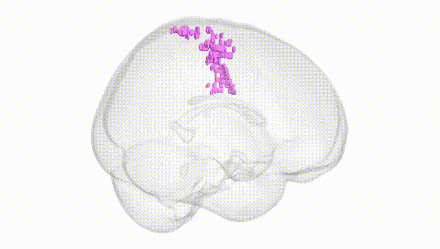 Full Brain White