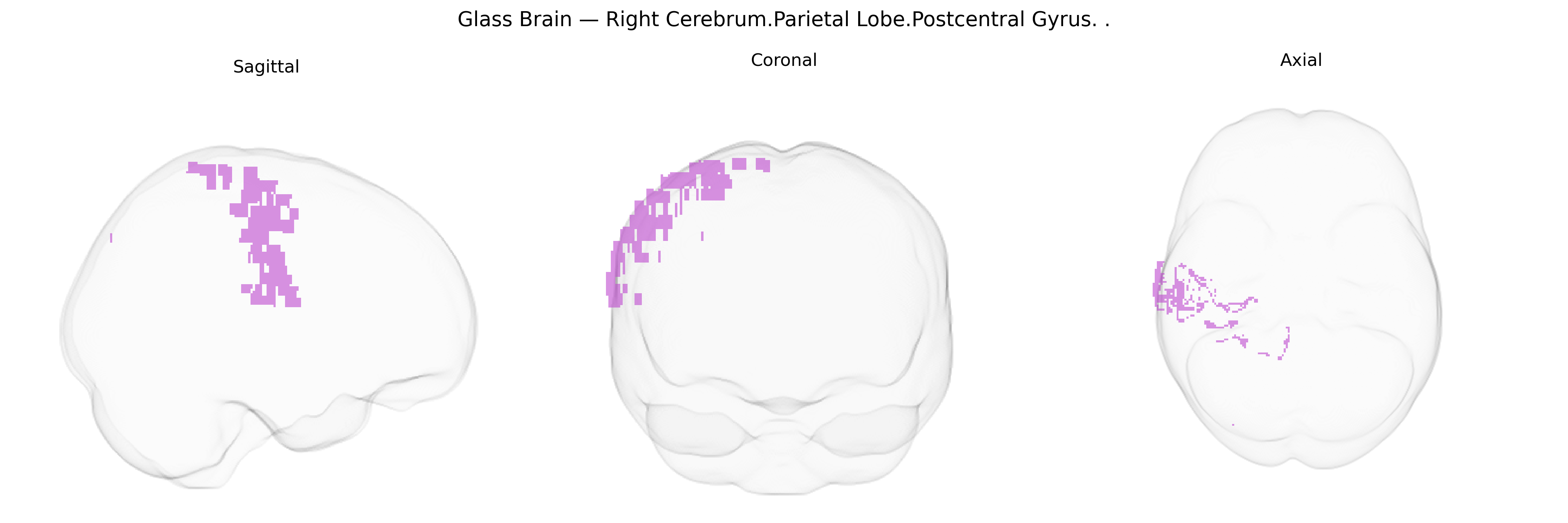 Triplanar Ghost Brain