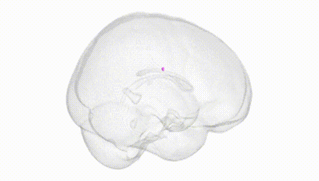 Full Brain White