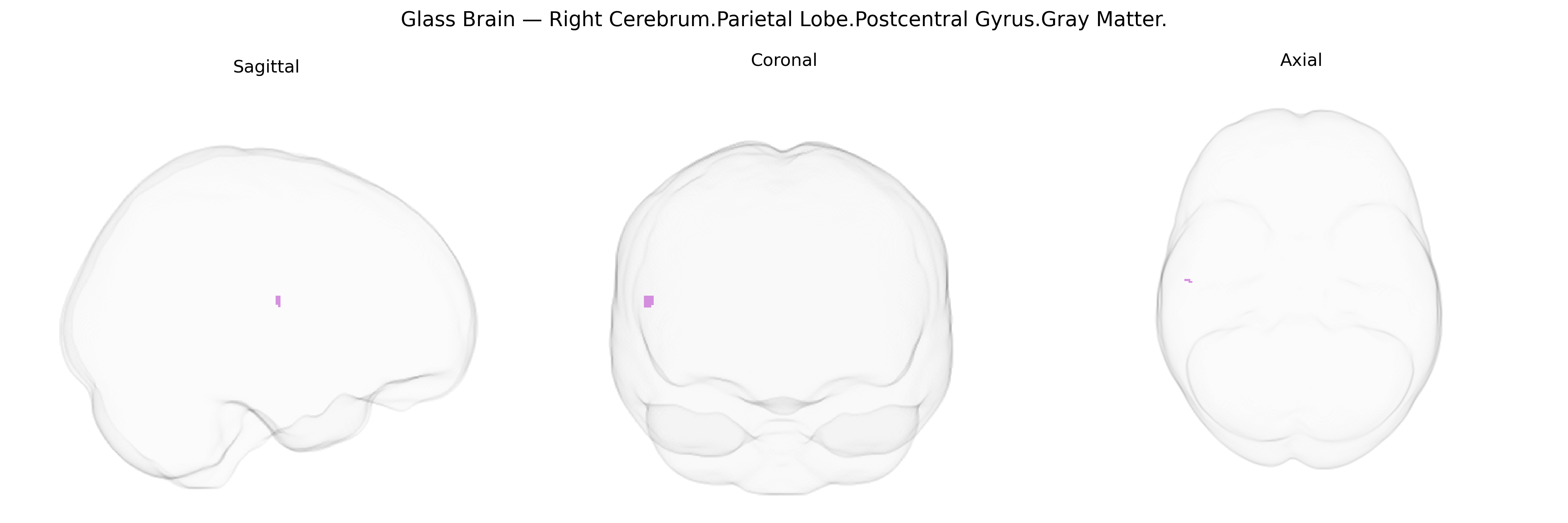 Triplanar Ghost Brain