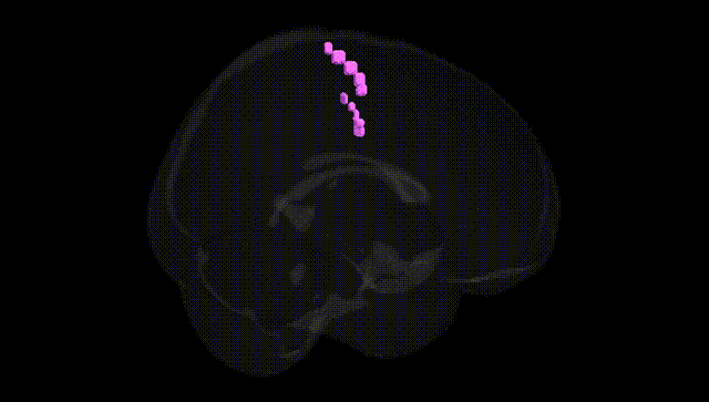 Full Brain Black