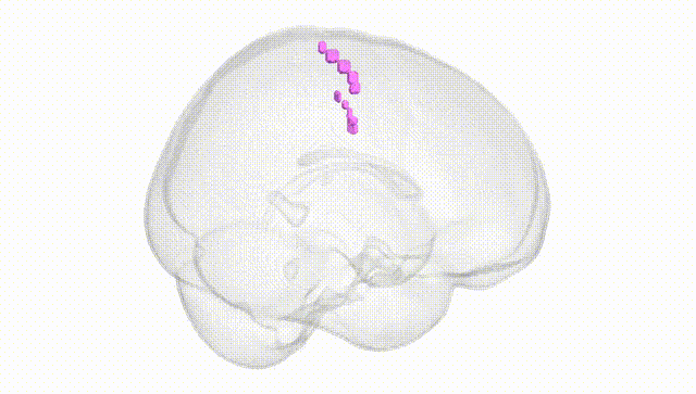 Full Brain White
